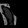 SPORK, NICO - 22.03.1976 - 02.08.2022 - CT obere Extremität - 18:01:46
